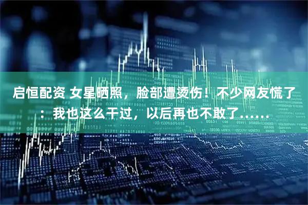 启恒配资 女星晒照，脸部遭烫伤！不少网友慌了：我也这么干过，以后再也不敢了……